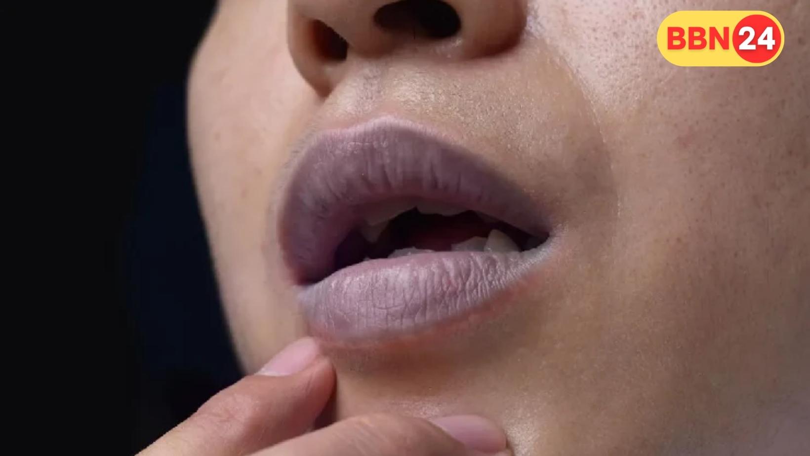 7 Home Remedies For Dark Lips