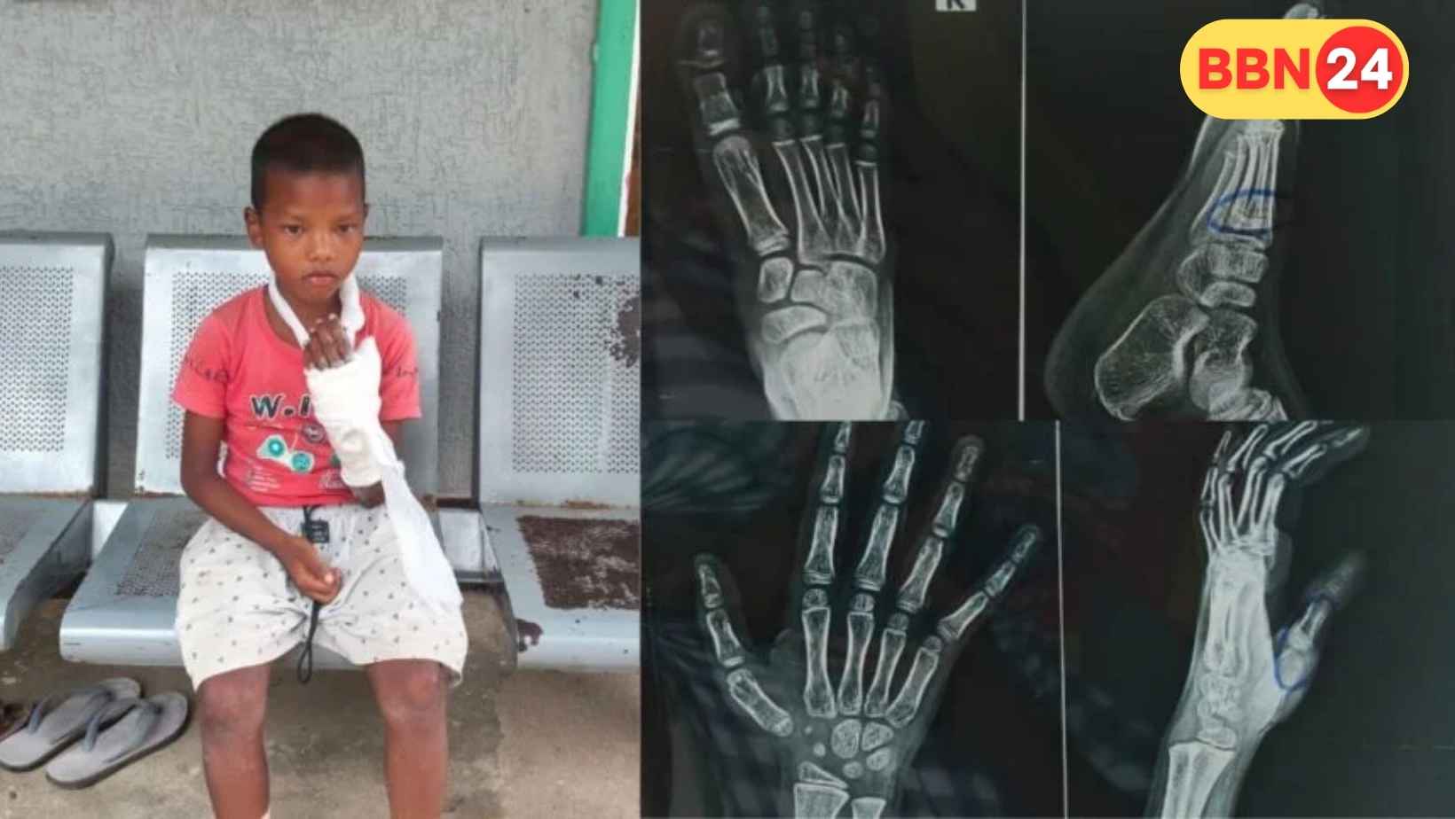 Lohardaga Teacher Assault Case